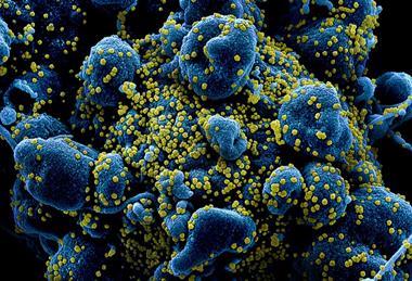Novel_Coronavirus_SARS-CoV-2_(49680384281)