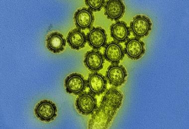 H1N1_Influenza_Virus_Particles_(8411599236)