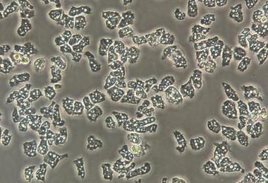 Low-Res_Acanthamoeba