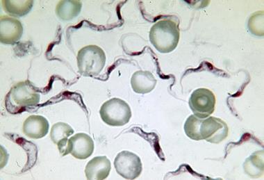 Trypanosoma-brucei