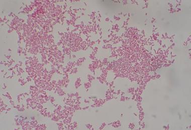 Escherichia_coli_Gram_Stain