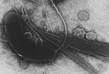 960px-Vibrio_cholerae (1)