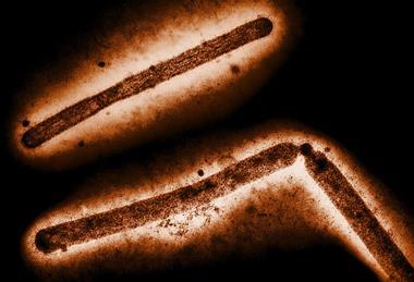Influenza_A_H5N1_Virus_Particles