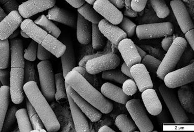Bacillus_cereus_SEM-cr