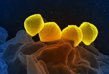 Streptococcus_Pyogenes_(Group_A_Strep)_(52602892639)