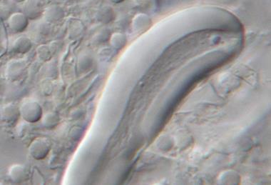 Aspergillus_ustus_Hulle_cell