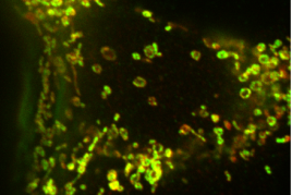 Mitochondrial_OMM_and_matrix_in_MEF_WT_CCCP