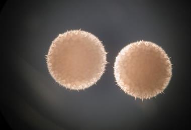 Streptomyces_hygroscopicus