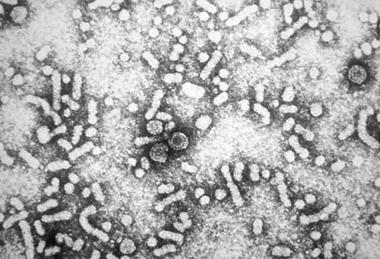 Hepatitis-B_virions