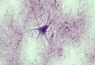 Nervous_Tissue_Spinal_Cord_Motor_Neuron_(41850849912)