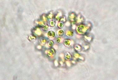 Microcystis_aeruginosa
