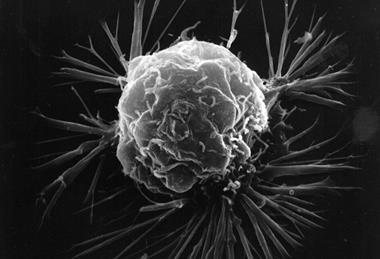 Breast_cancer_cell_(2)
