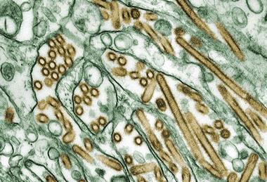 Colorized_transmission_electron_micrograph_of_Avian_influenza_A_H5N1_viruses