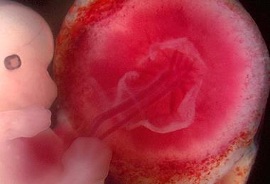 Fetus_and_placenta_-_journal.pbio.0060312.g001