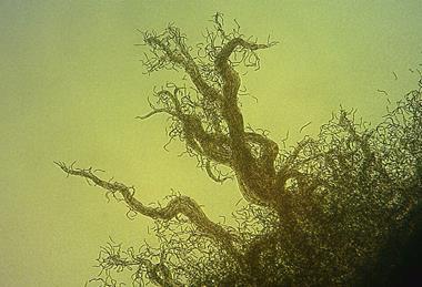 Nostoc_with_hormogonia_40x