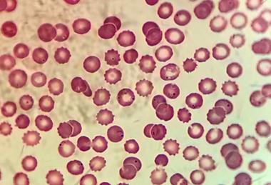 Plasmodium_in_erythrocytic_cycle
