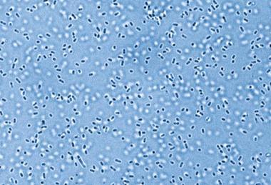 Low-Res_25-06-19_Leibniz-HKI_Pandoraea