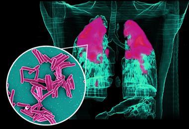 Mycobacterium_Tuberculosis_Bacteria,_the_Cause_of_TB_(52764953115)