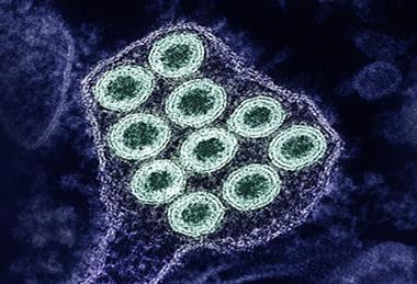 Colorized_transmission_electron_micrograph_of_rabies_virus_particles_(green)_image_captured_at_the_NIAID_Integrated_Research_Facility_in_Fort_Detrick,_Maryland_-_1