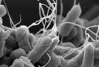 E-coli_(Escherichia_coli)