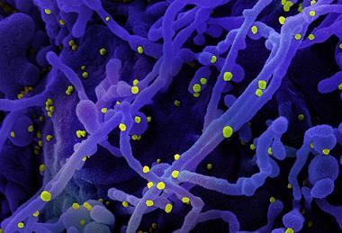 Novel_Coronavirus_SARS-Cov-2_(50010746961)