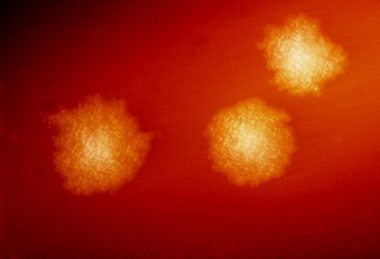 Clostridium_difficile_colonies