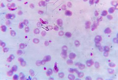 Plasmodium_falciparum_gametocyte