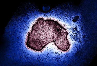 Human_Respiratory_Syncytial_Virus_(RSV)_-_2111