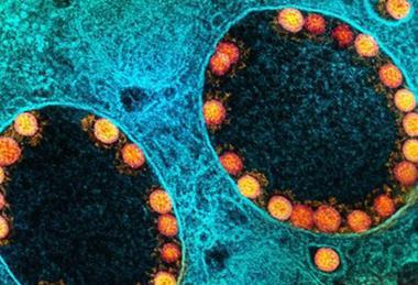 Low-Res_COVID-19 NIAID