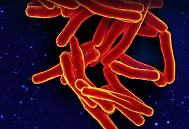 Mycobacterium_Tuberculosis_Bacteria,_the_Cause_of_TB_(52766723188)