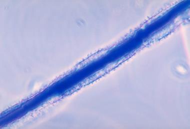 Aspergillus_flavus_01