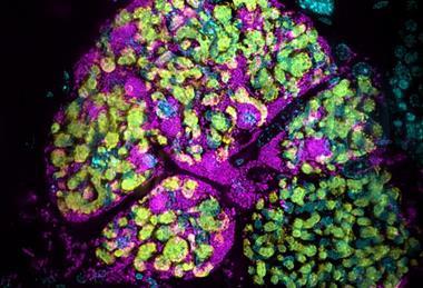 Low-Res_Infected_bacteriome__Ronja_Kruesemer