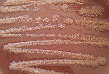 Pseudomonas_stutzeri