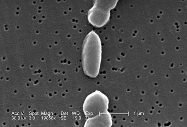 Vibrio_parahaemolyticus_01