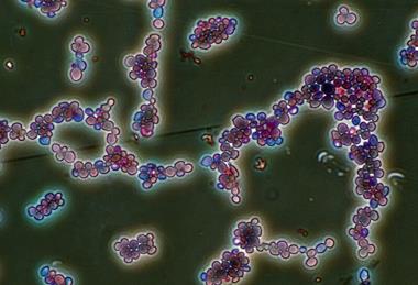 Candida_albicans_(251_12)