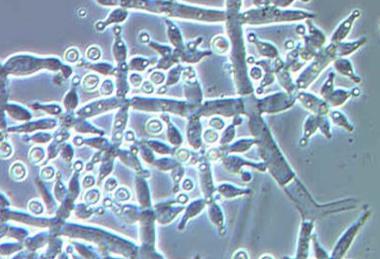 Trichoderma_harzianum