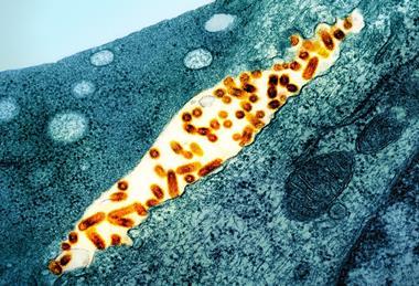 Vesicular_Stomatitis_Virus_(VSV)_particles_(orange)_found_in_extracellular_space_and_budding_from_the_plasma_membrane_of_infected_cells_(teal)