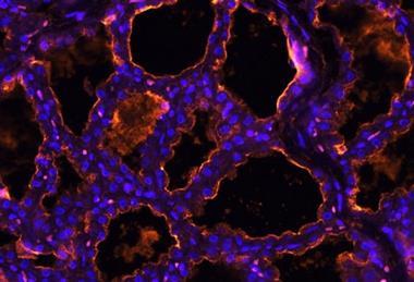 Low-Res_flureceptros12-25_2