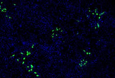 Low-Res_Virologie-HEV