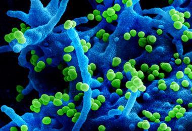 Lassa_Virus_-_51719109817