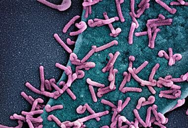 Marburg_virus_outbreak