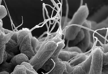 E-coli_(Escherichia_coli)