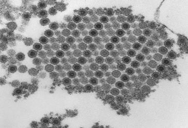 960px-Chikungunya_virus_particles-PHIL-17369
