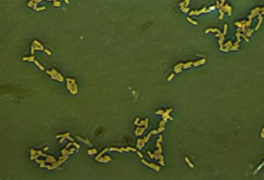 Escherichia_coli_(257_06)_Gramnegative_rods (1)