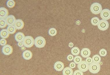 Cryptococcus_neoformans_using_a_light_India_ink_staining_preparation_PHIL_3771_lores
