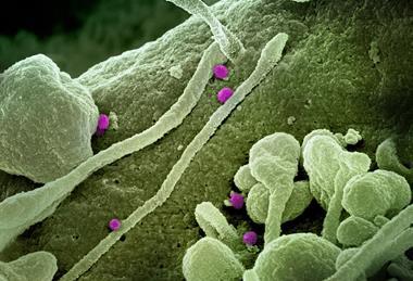 Crimean-Congo_Hemorrhagic_Fever_(CCHF)_Virus_-_3