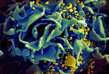 HIV-infected_T_cell_(6813489183)