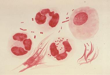 Neisseria_gonorrhoeae_PHIL_3693_lores