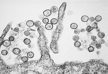 Sin_Nombre_hanta_virus_TEM_PHIL_1136_lores