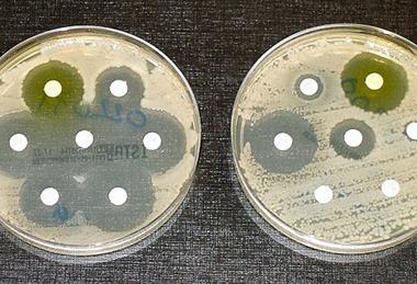 E. coli antibiotic_sensitivity_and_resistance